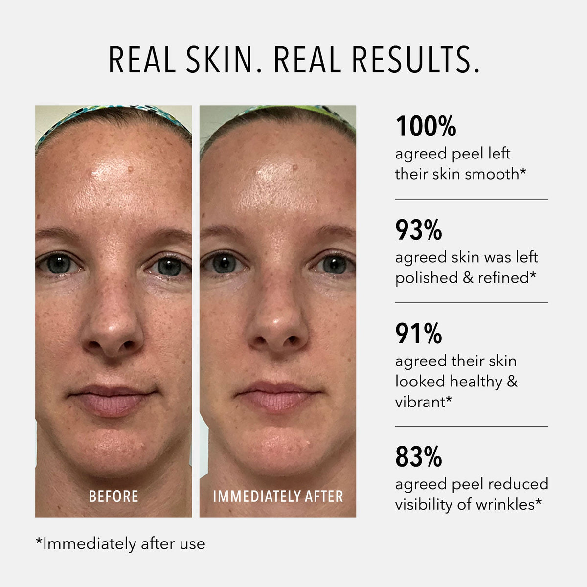 Polish & Plump Face Peel product detail